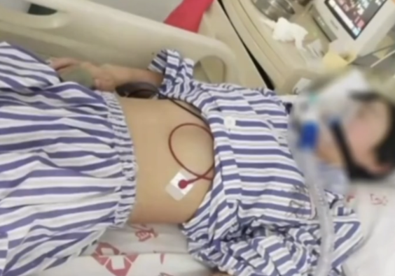 河北女学生被姐夫下毒后续：需要肺移植，姐夫称被看不起才下毒