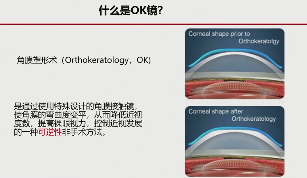 OK镜来了！你需要知道这几件事