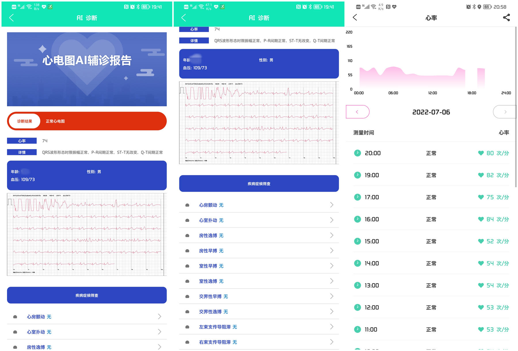 全天候血壓心電圖監測，全能健康小管家，dido智能手表評測