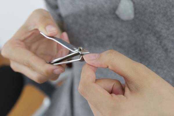 识别指甲的“求救信号”，4种异常表现的指甲，要及时排除癌变