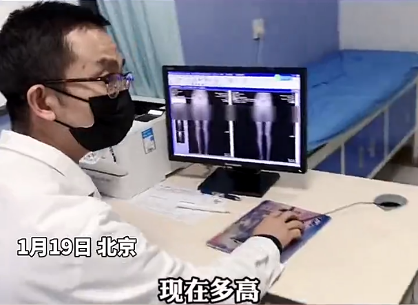 女大学生要求“截骨变矮”，竟是为了要“合群”，真实身高亮了