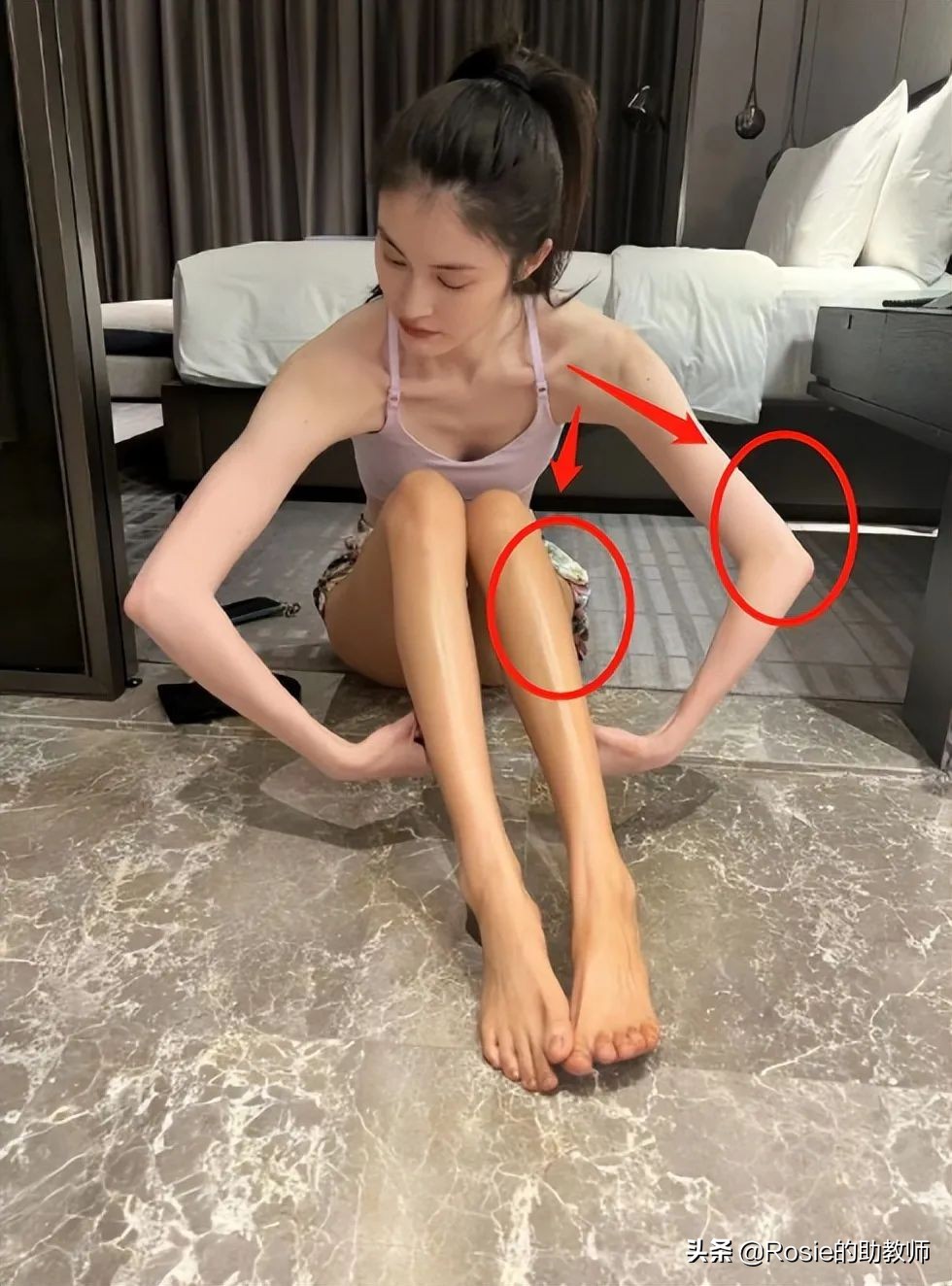 何穗晒照胳膊小腿一样粗，小腿粗壮弯如何瘦？找对成因这样做