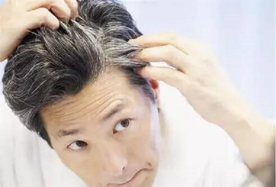 为何白头发会越长越多？不要觉得自己老了，或许是缺少这3种营养