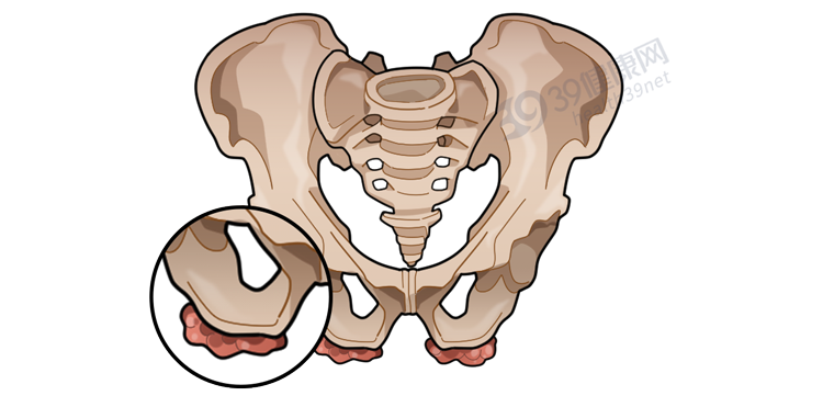 久坐对人体有什么危害？可能会得3种病，经常坐着的人看看吧