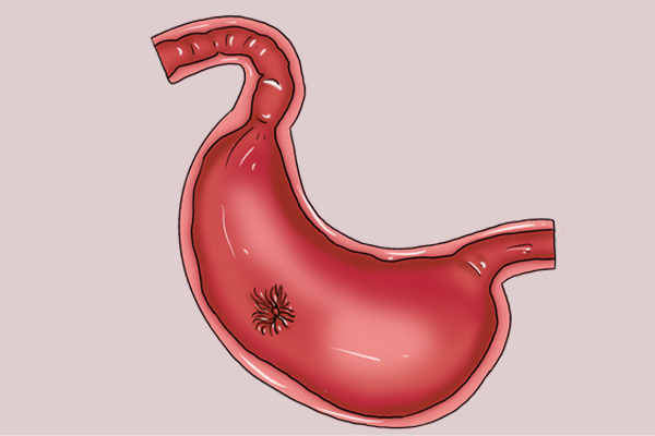 犯胃病除了吃药还能怎么办？三分治，七分养，记住“1勤2宜3忌”