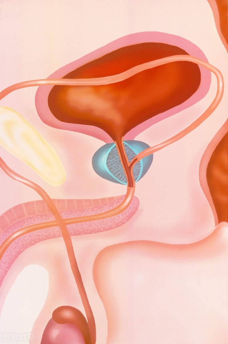 小便次数多，每次又很少，有时候还有尿分叉，原因找到了