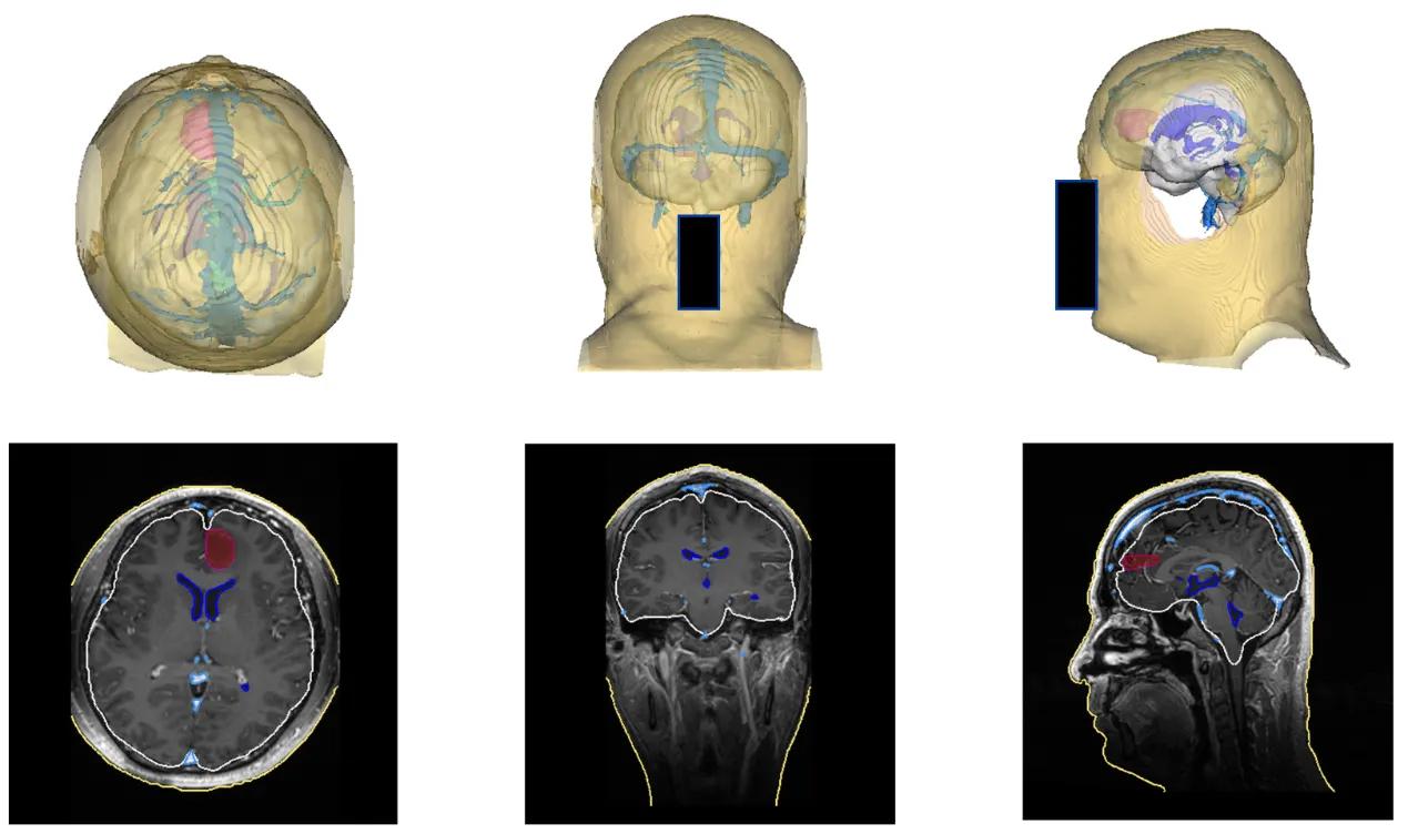 手术配上GPS 北京协和医院与腾讯联合发布国产手术导航系统