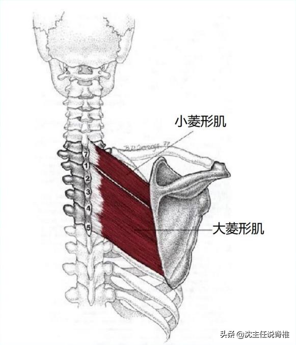 后背、肩胛骨内侧缘疼痛，排除了内科疾病，还要注意这个原因