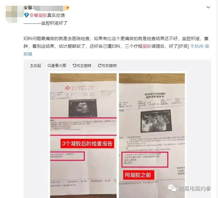 旗下多款产品存在责令改正记录,安馨微商的奖金制度有何种魅力?