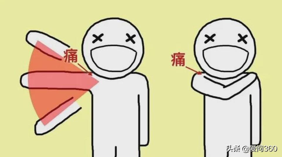 人到50岁就容易犯肩周炎，如何预防肩周炎？几个措施中保暖很重要