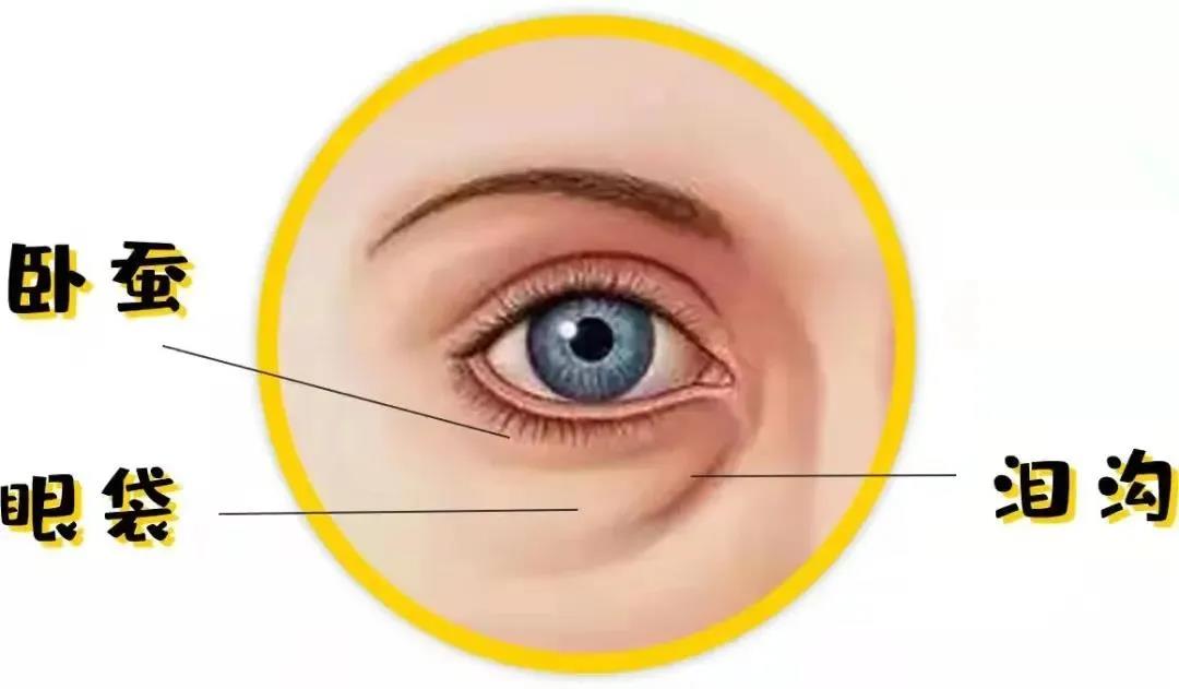 卧蚕、眼袋、泪沟，你还在傻傻分不清楚嘛？