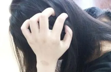 美克拉分享：养发护发小技巧，减少脱发掉发