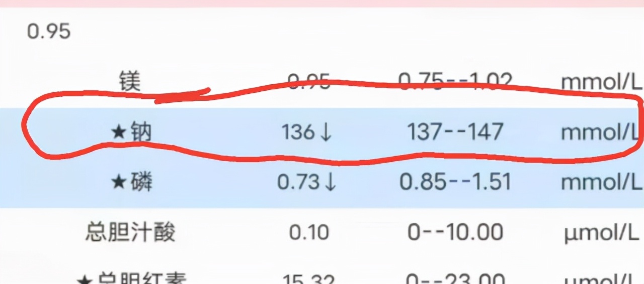 不是所有人，都要少吃盐！医生提醒：以下3类人，不能少吃盐