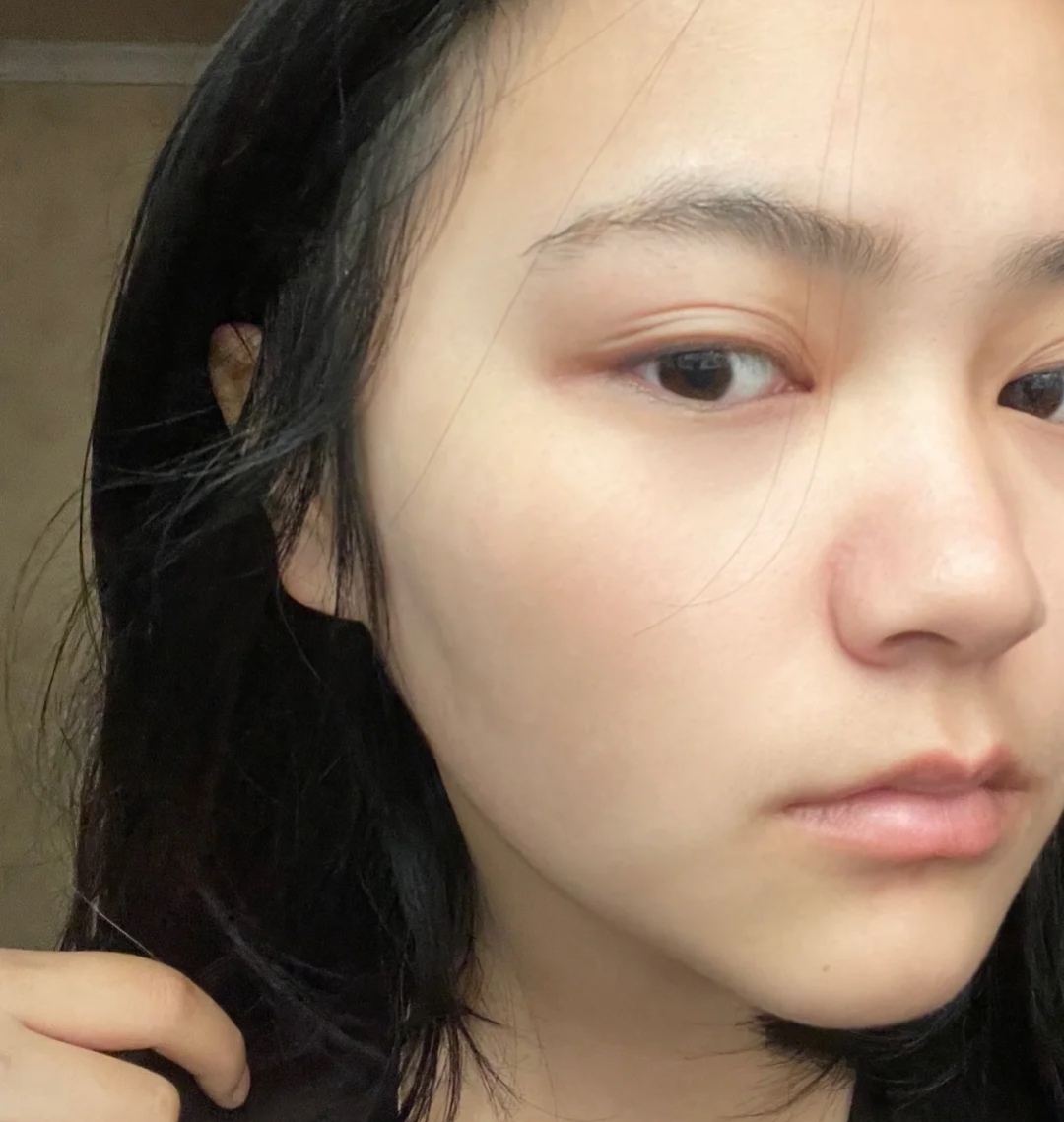 早C晚A这阵风你跟了吗？其一建立耐受，重在防反黑，不可操之过急