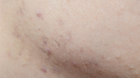 女人坚持佩戴银手镯，对身体有何影响？究竟是好事还是坏事？