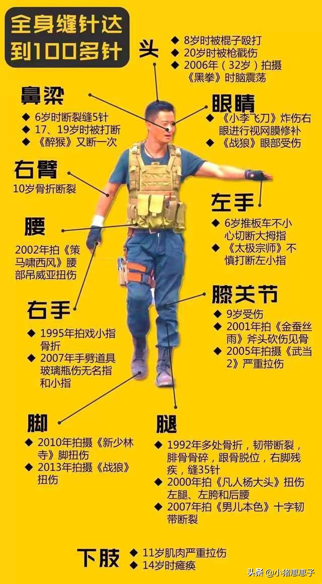 比杨幂眼角受伤更惨烈8位明星：烧伤、毁容、中弹、瘫痪、丧命