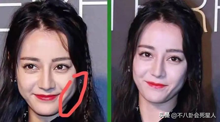 五官好看，“吃亏”在脸上，热巴脸颊凹陷，鞠婧祎颧骨突出