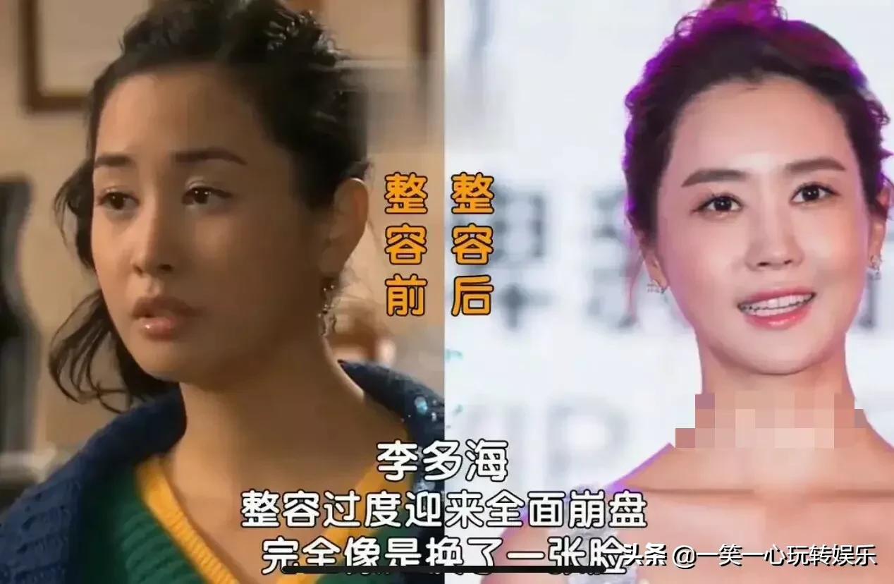 韩国明星变美“后遗症”，朴春360度崩盘，李多海变僵尸脸