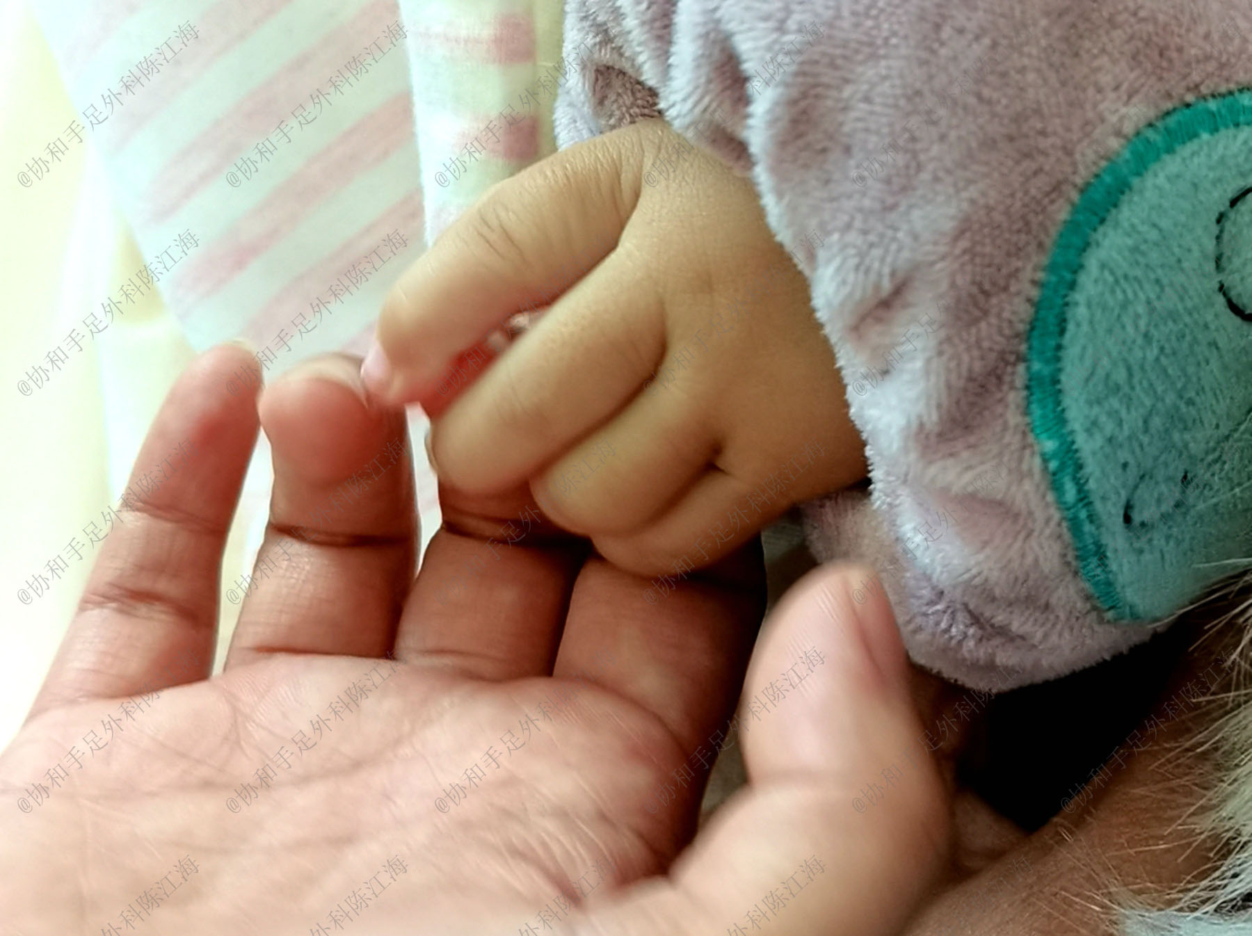 儿媳手术室产子两小时，宝宝出生右手拇指悬浮，婆婆反应让人点赞