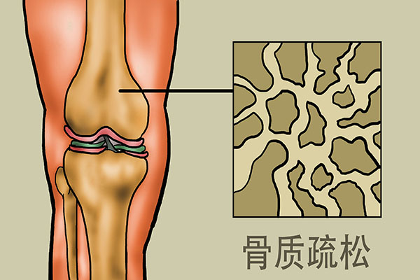 老年人摔一跤，结果有多严重？60岁以后，3种食物要舍得吃