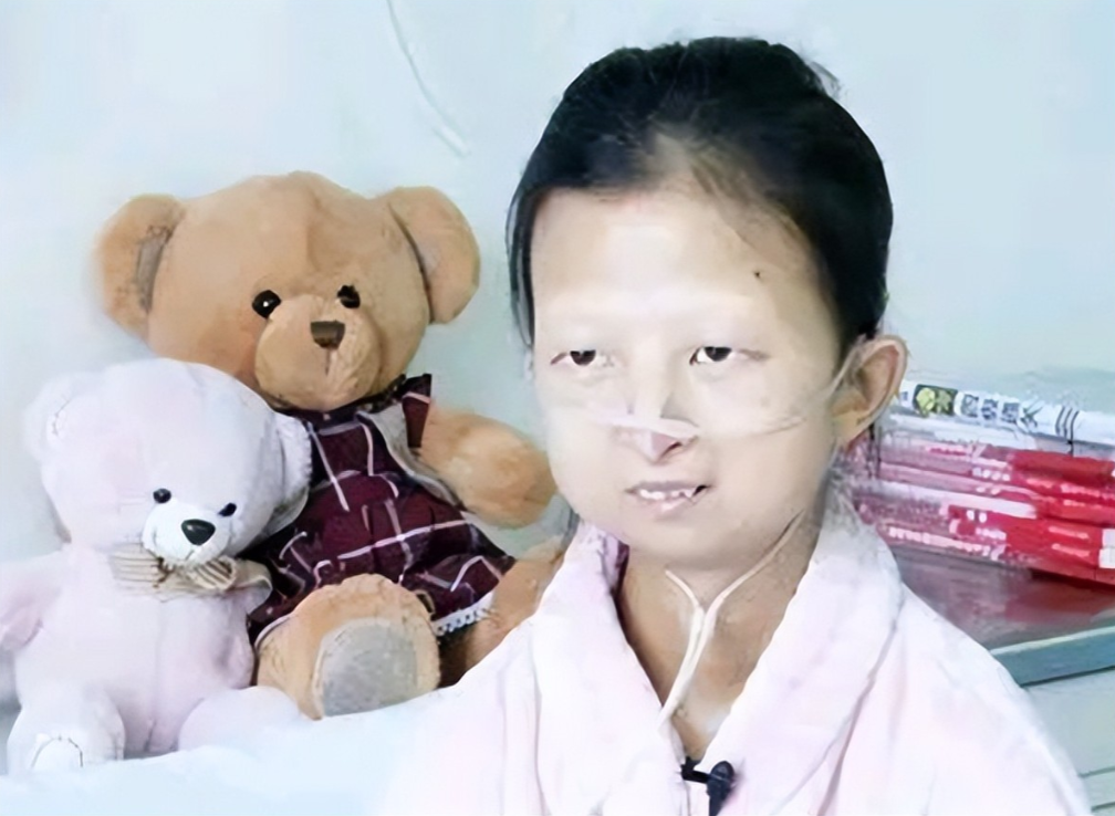 43斤女大学生，为救弟弟吃多年辣椒拌饭，去世前得知男友癌症病逝