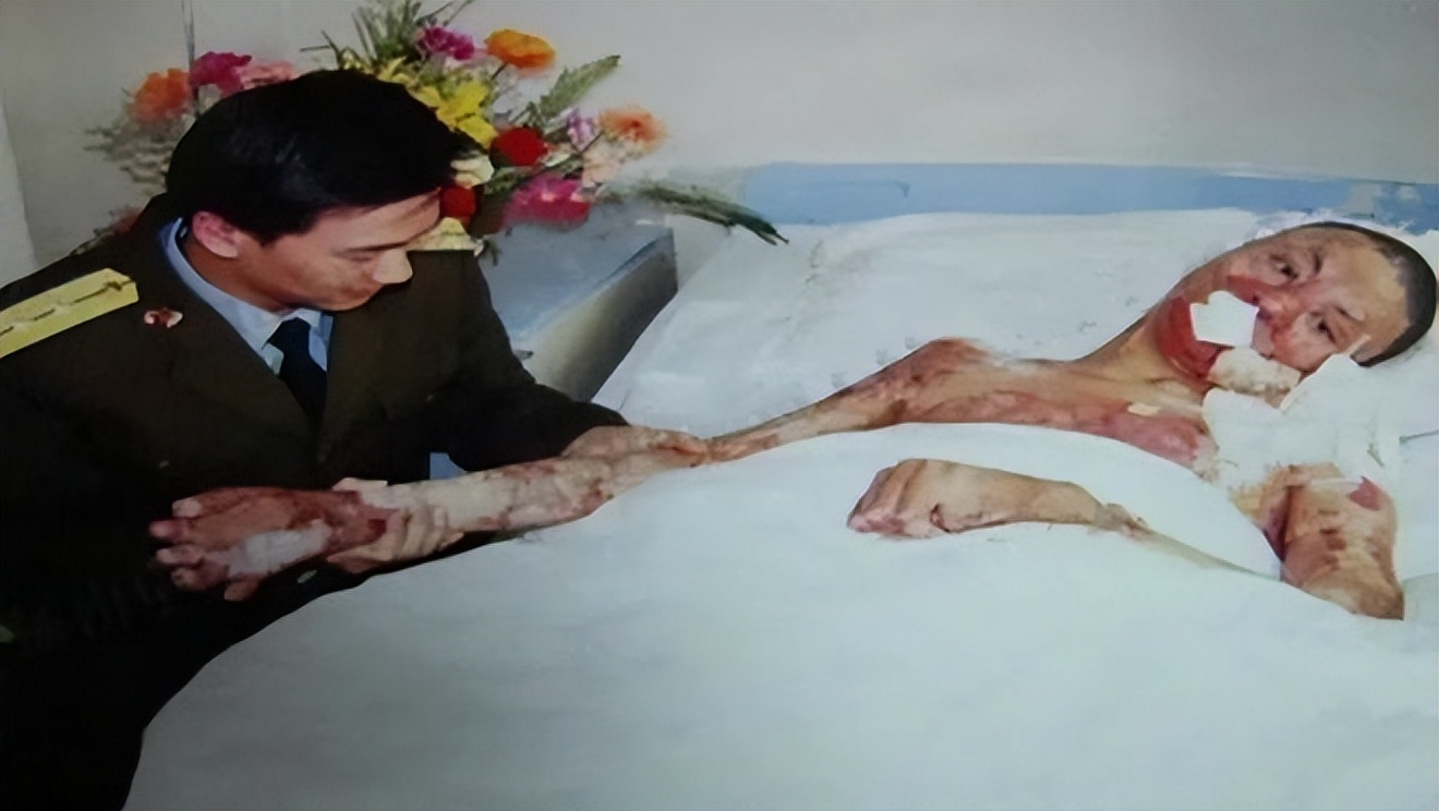 21岁战士救火毁容，女白领不顾反对嫁他，结婚时市长和首长都来了