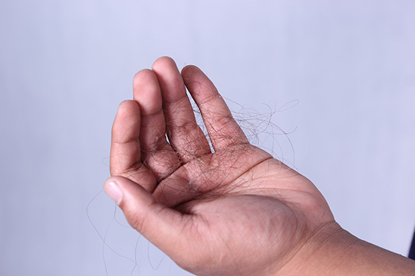 2.5亿人快秃了，用米诺地尔能生发、防脱？是真的，但没这么简单