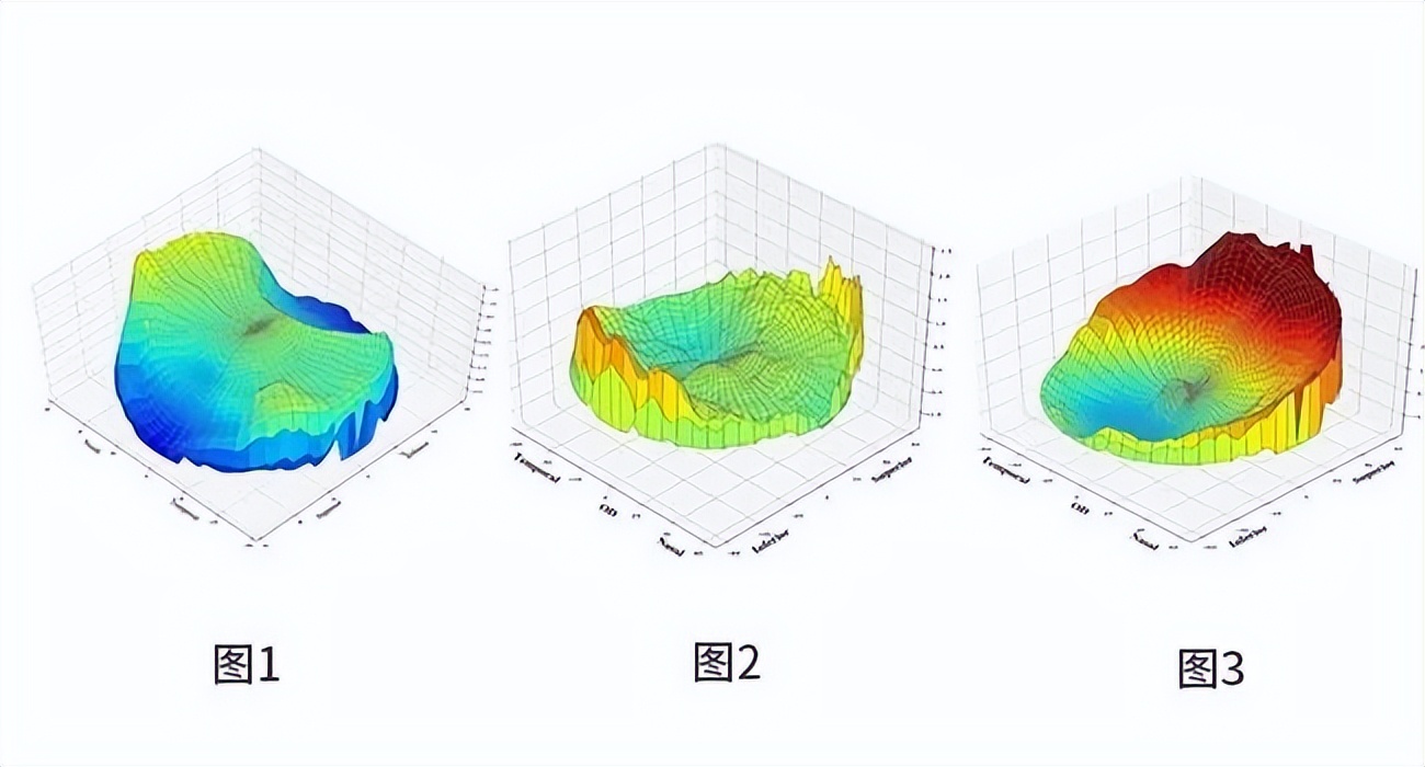 这台神秘的仪器有多厉害？兰州爱尔引进MRT（多光谱屈光地形图）