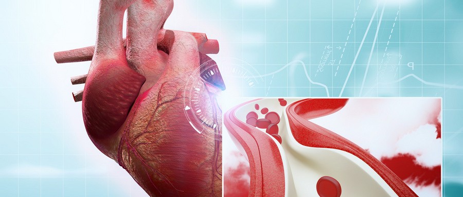 心臟血管堵塞有多可怕？ 這些壞習慣一定要改掉
