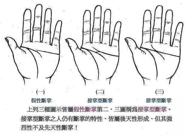 箕代贫、斗寓富、断掌的智慧高？中科院最新研究揭开指纹基因奥秘