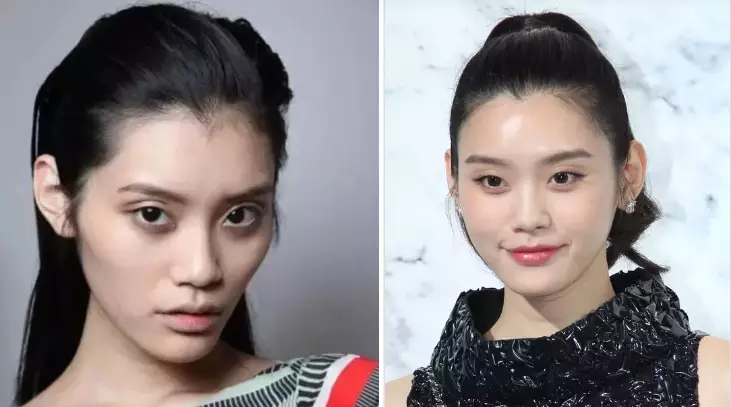 鼻子塌不可怕，面中凹才拉胯，显苦显凶还显老，许多女星深受其害