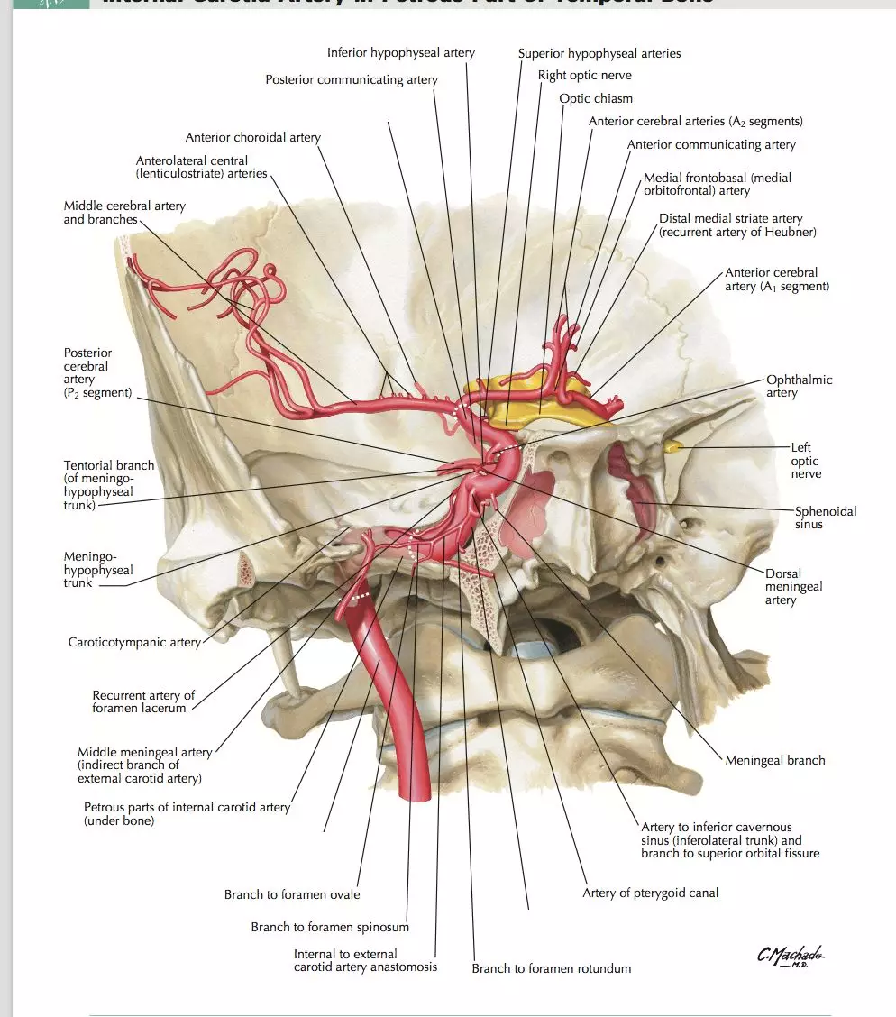脑血管造影上,对颈内动脉理解最关键的就是岩段的走行.