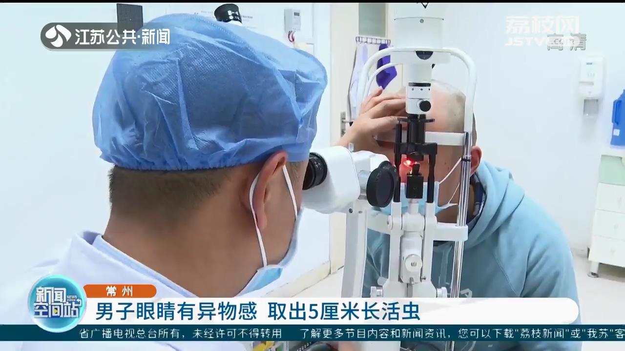 常州一男子眼睛有异物感 医生手术取出5厘米长活虫