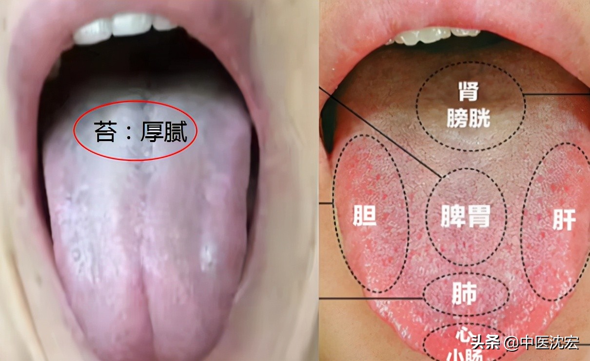 体内有瘀用血府逐瘀没用？舌象告诉你原因，2味中药、去瘀生新