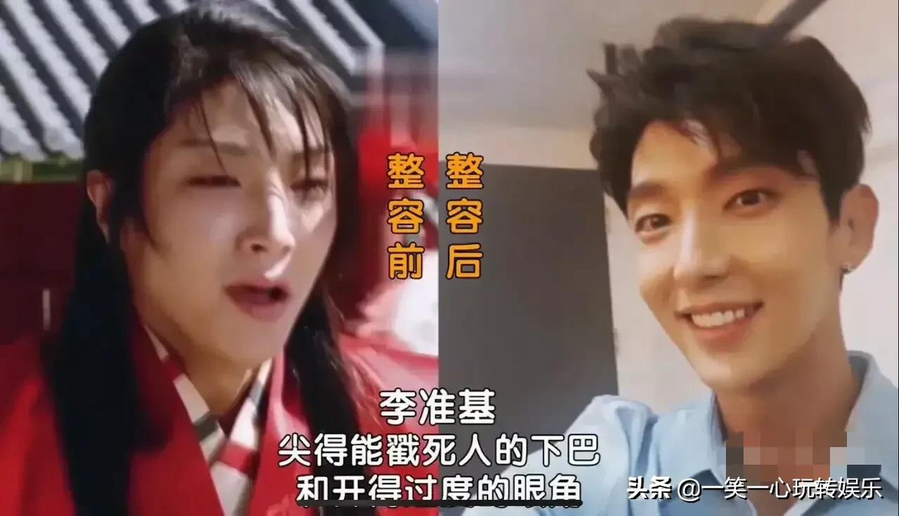 韩国明星变美“后遗症”，朴春360度崩盘，李多海变僵尸脸