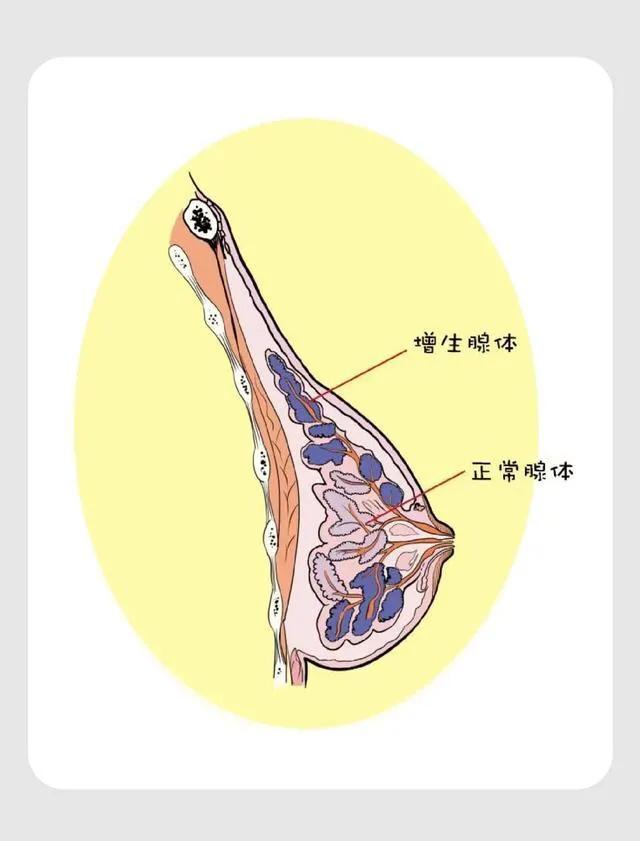 体检查出这19种疾病，医生：其实根本不用治！别再花冤枉钱