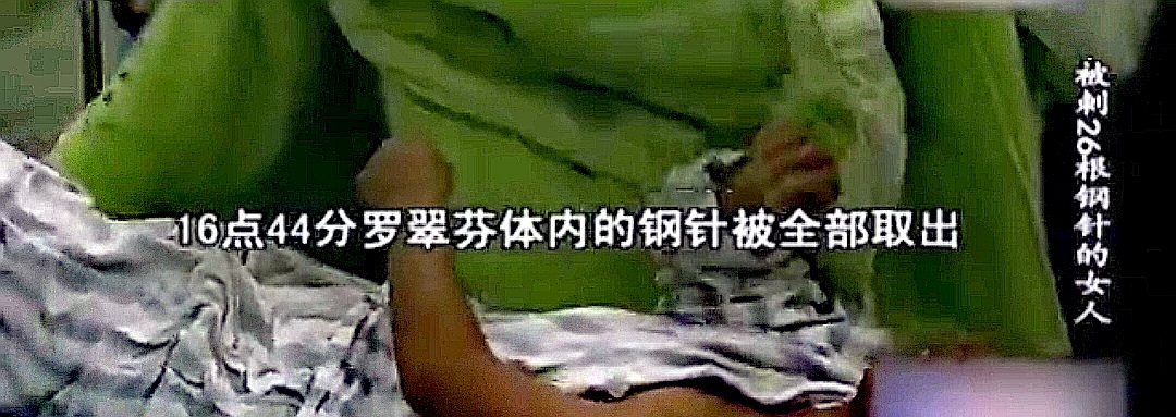 2004年，农妇体内发现藏26根缝衣针，头部钢针直插大脑，凶手成谜