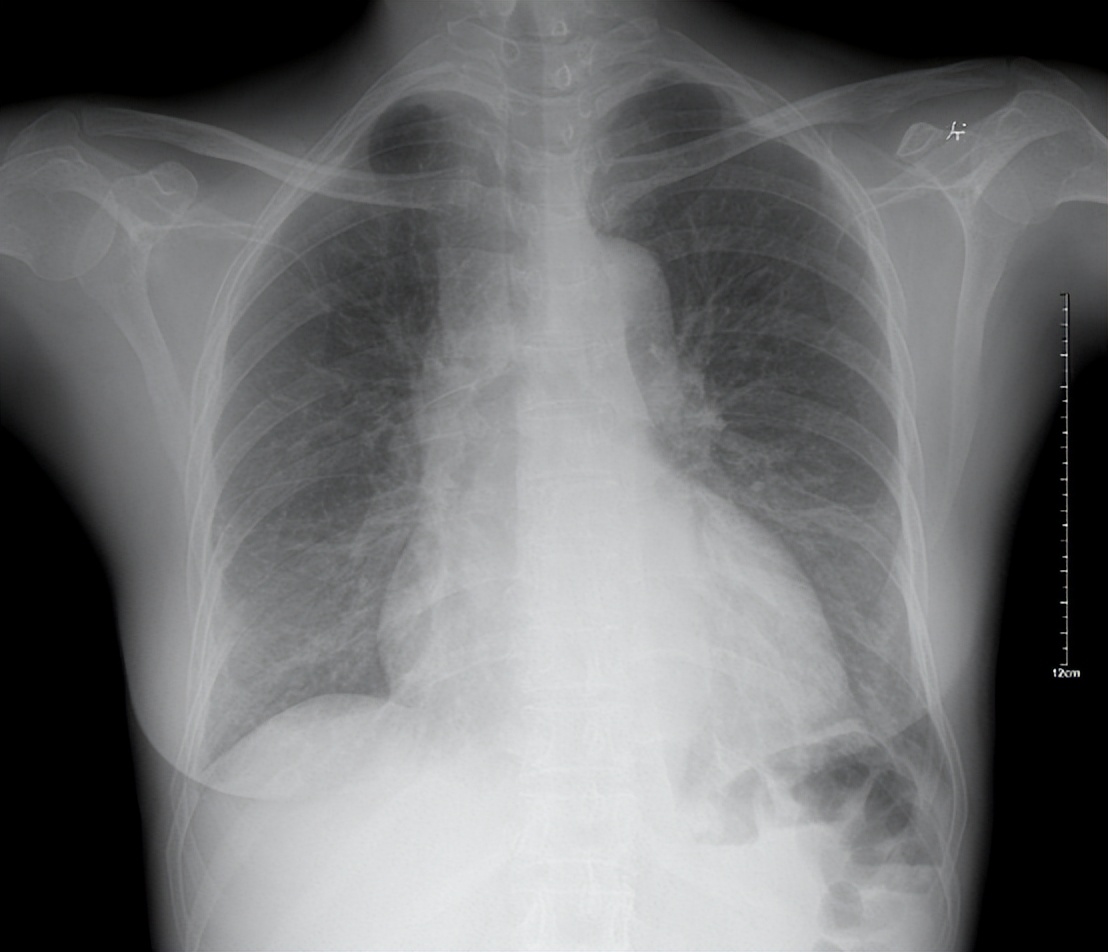 嗓子里总有痰，痰多吐不完？教你4招，切断“生痰之源”