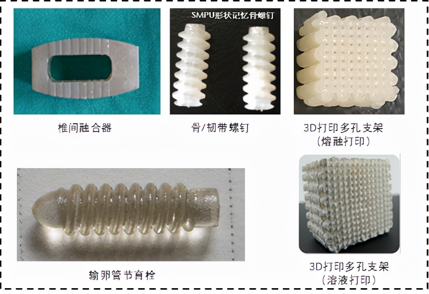 重庆大学材料学院（骨科患者的福音）