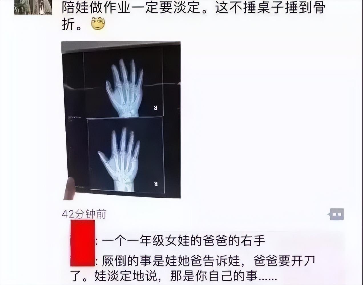 快放暑假了，步步高家教机S6解救“恐辅症”家长