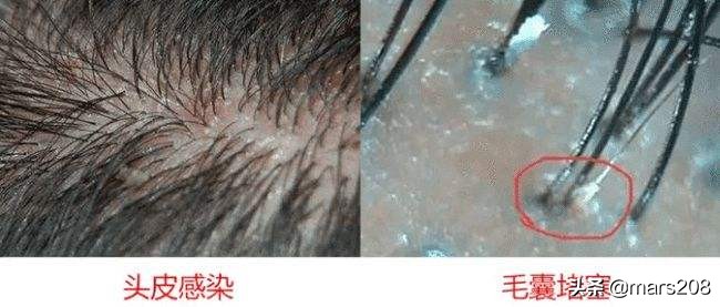 加班熬夜到头秃？6款防脱洗发水真实体验，告别油头，拯救秀发