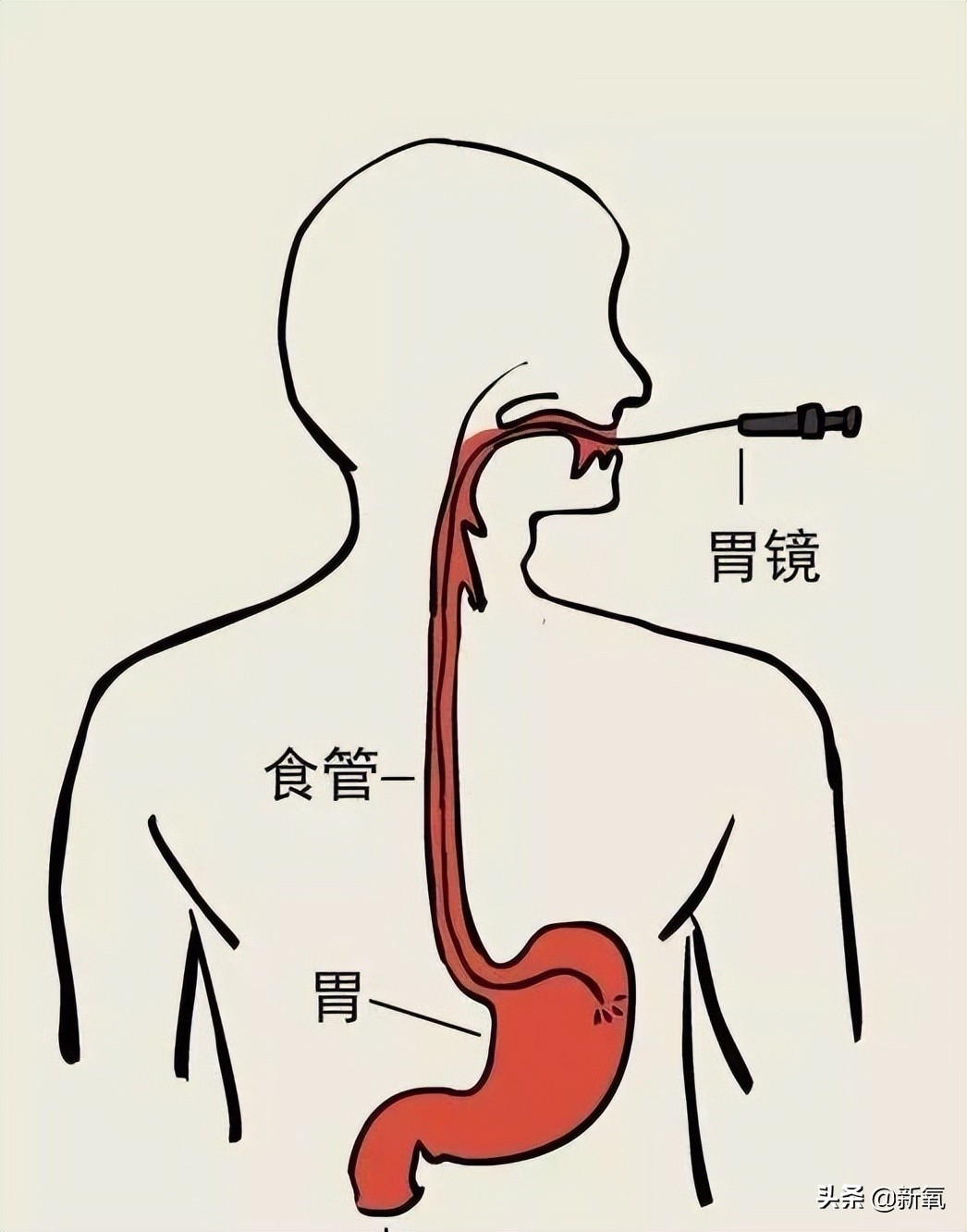 投胎这事真是被她拿捏了，合理怀疑在娘胎里她给自己捏了脸