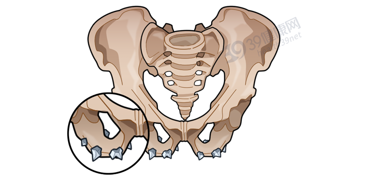 久坐对人体有什么危害？可能会得3种病，经常坐着的人看看吧