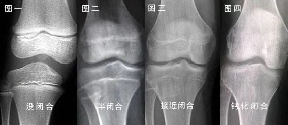 儿童生长发育，这3件事很容易被家长忽略