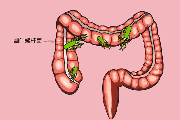 胃癌患者福音！国家医保“喜提”18种抗癌药，胃癌抗癌药也在其中