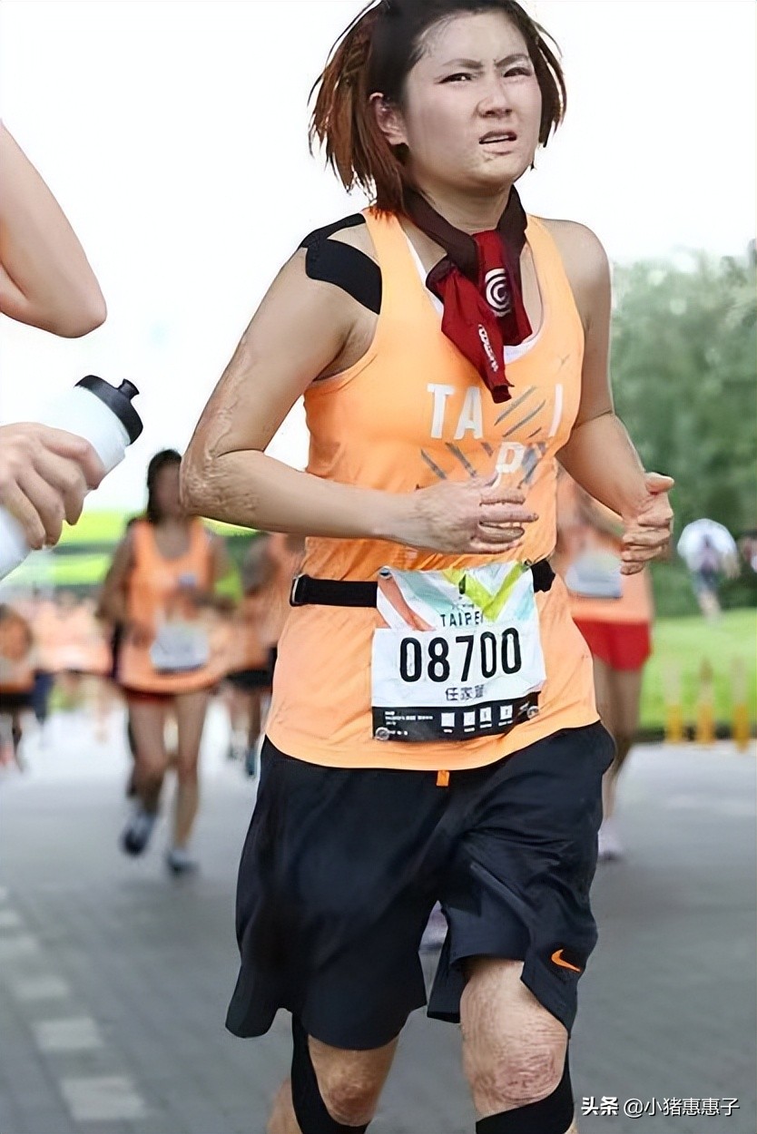 比杨幂眼角受伤更惨烈8位明星：烧伤、毁容、中弹、瘫痪、丧命