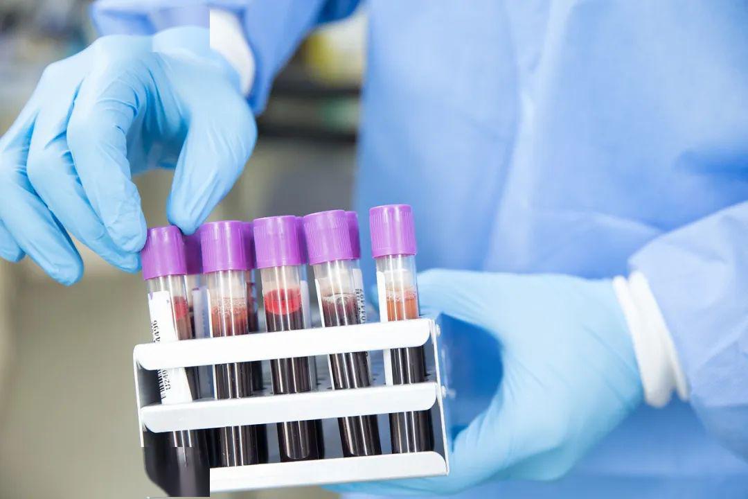 肝脏能够合成蛋白，所以肌肉强肝就好？肝脏功能好不好，如何检查