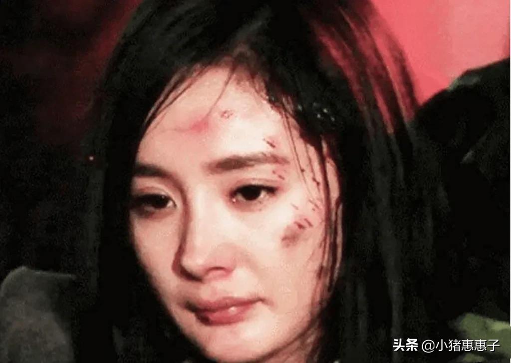 比杨幂眼角受伤更惨烈8位明星：烧伤、毁容、中弹、瘫痪、丧命