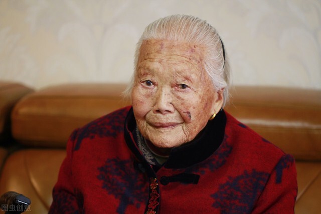 为什么老年人身上会长老年斑？医生建议做好4件事，可以有效改善