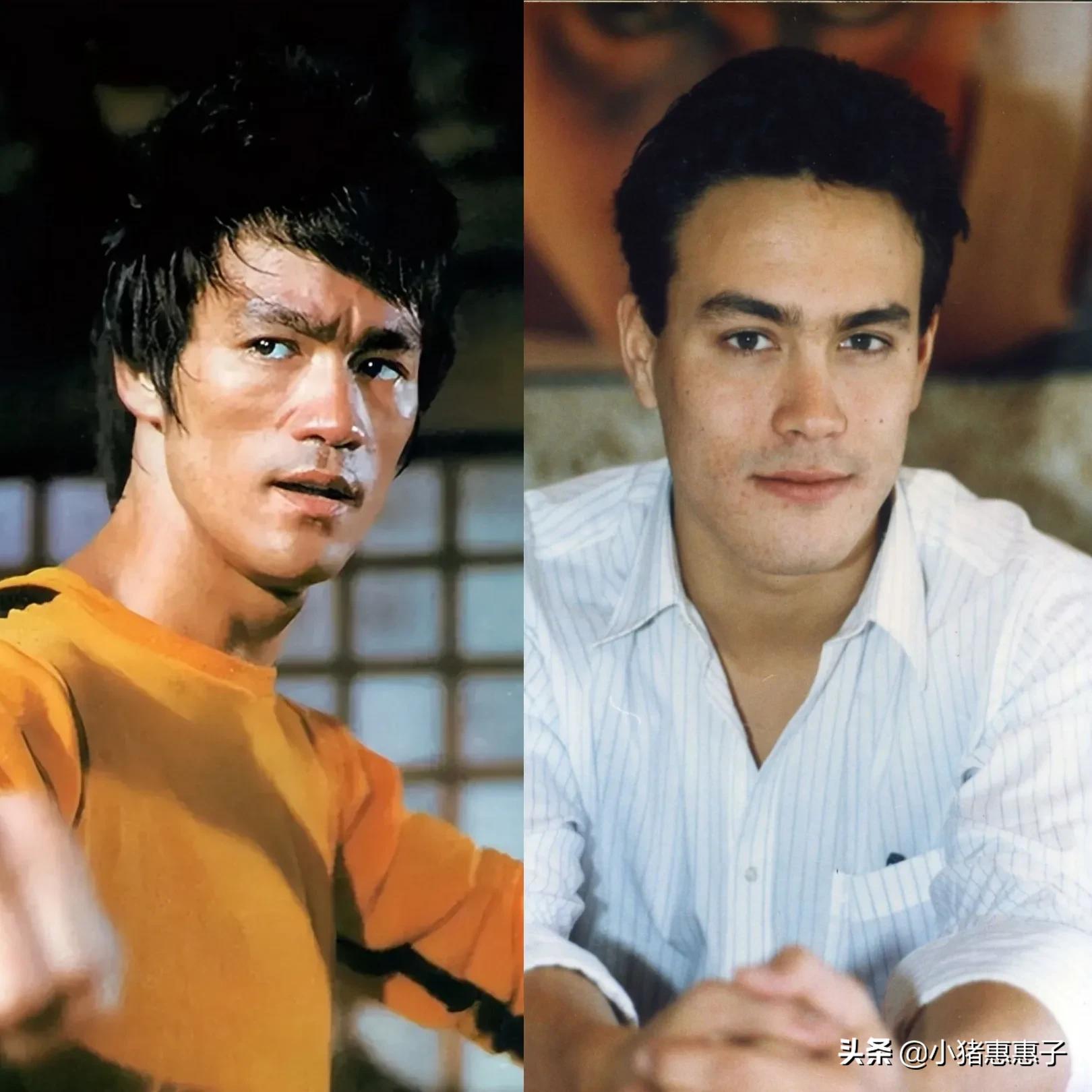 比杨幂眼角受伤更惨烈8位明星：烧伤、毁容、中弹、瘫痪、丧命